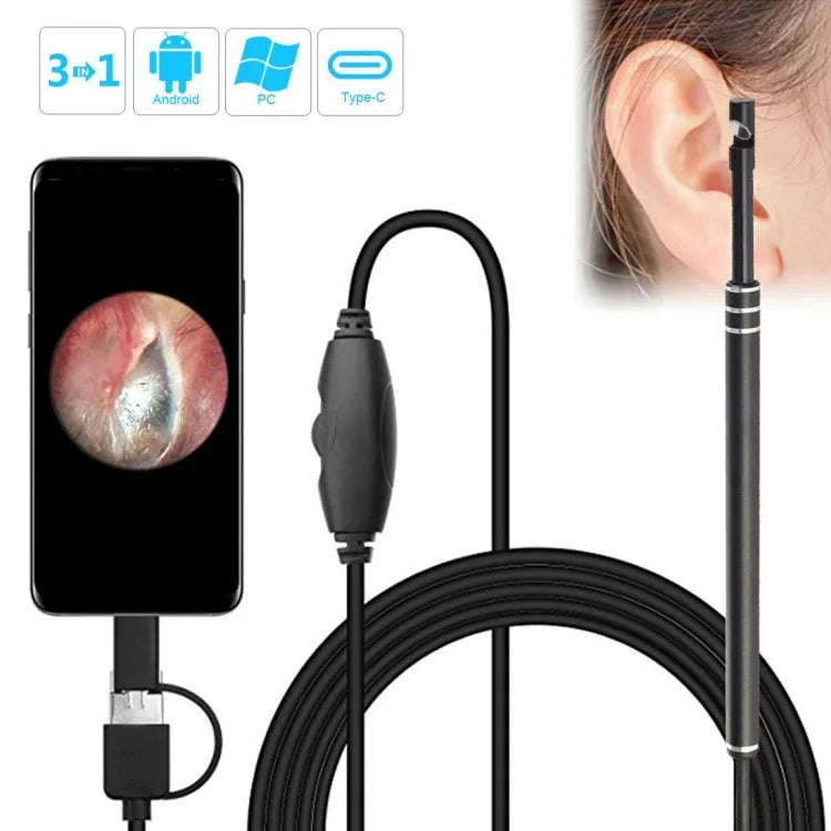 i96 3 in 1 USB Ear Scope Inspection HD 0.3MP Camera Visual Ear Spoon for OTG Android Phones & PC & MacBook, 1.85m Length Cable, 3 in 1 Black  0.3MP