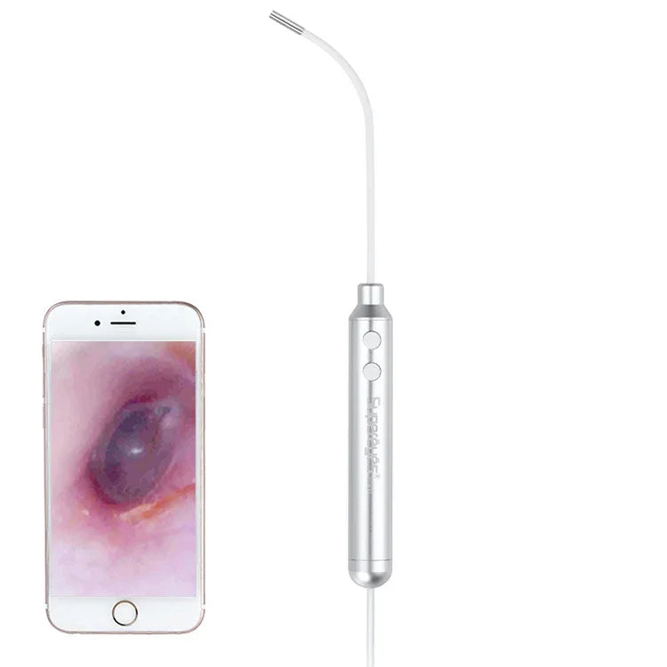 Supereyes Y001 Ear Mite Mouth Electronic Digital Fixed Focus Endoscope, Y001