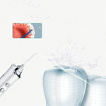 Electric Tooth Punch Dental Scaler Water Floss Household Portable Oral Cleaning Machine, White, Pink, Blue