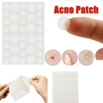 3 PCS Acne Tool Set Treatment Acne Scar  Pimples Sticker
