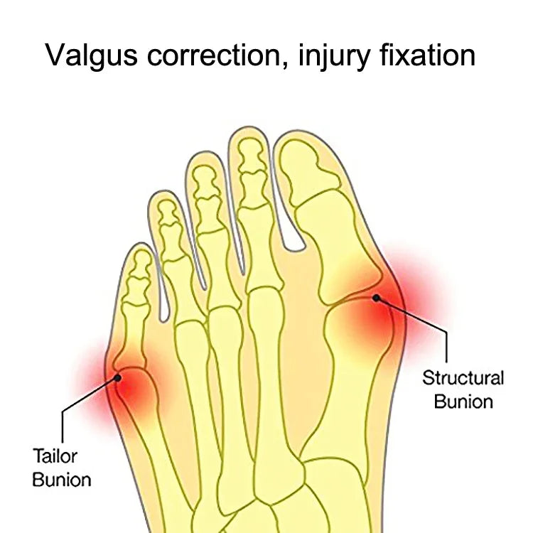 1 Pairs Wearable Shoes Big Toe Valgus Corrector Toe Comfortable Splitter, S, L
