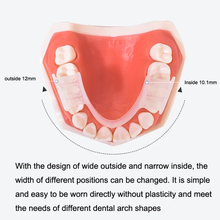 Y-Kelin Orthodontic Appliance Silicone Simulation Braces Anti-Molar Braces For Night, Transparent